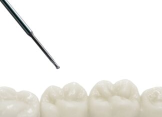 High-Tech-Beschichtung für Dental-Fräswerkzeuge